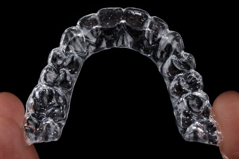 Understanding the Cost of Queensway Invisalign Treatment